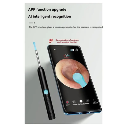 Visual Ear Cleaning Tool Set